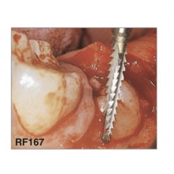 RF167