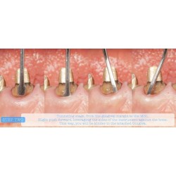 INSTRUMENTO TUNELIZACION DR. RICARDO KERN FIGURA 2 MANGO NARANJA PEEK